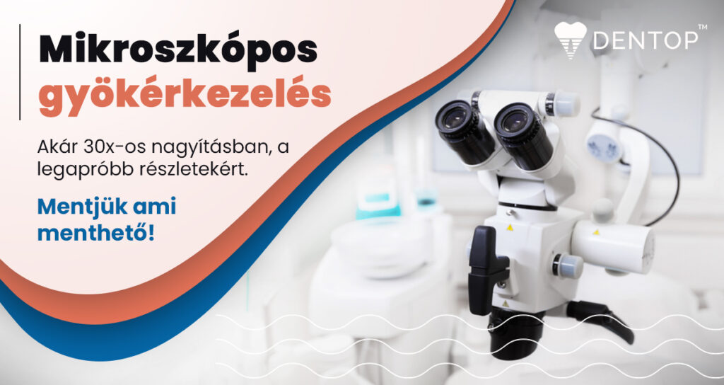 mikroszkópos gyökérkezelés